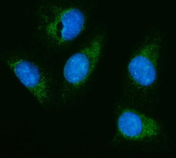 HEXA Rabbit Polyclonal Antibody