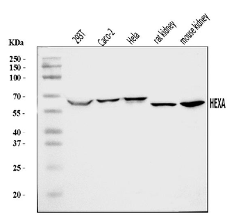 HEXA Rabbit Polyclonal Antibody