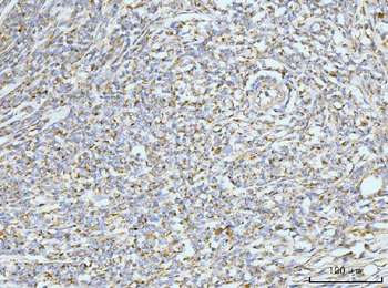 GRPEL1 Rabbit Polyclonal Antibody