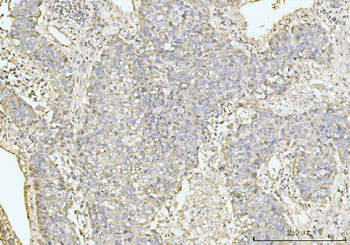 GRPEL1 Rabbit Polyclonal Antibody