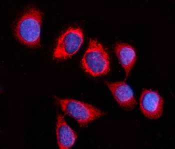 GSPT1,2/GSPT1 Rabbit Polyclonal Antibody