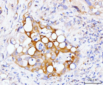 GSPT1,2/GSPT1 Rabbit Polyclonal Antibody