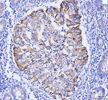 GSPT1,2/GSPT1 Rabbit Polyclonal Antibody