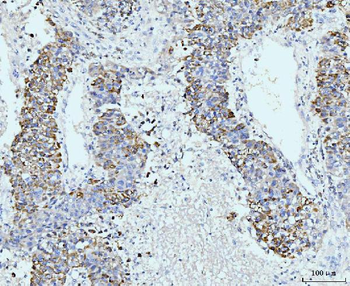 GSPT1,2/GSPT1 Rabbit Polyclonal Antibody
