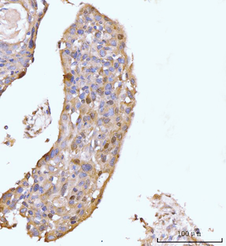 HMGCS1 Rabbit Polyclonal Antibody