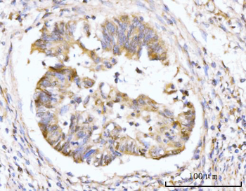 HMGCS1 Rabbit Polyclonal Antibody