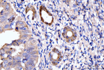 HMGCS1 Rabbit Polyclonal Antibody