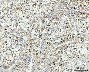 HMGCS1 Rabbit Polyclonal Antibody