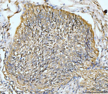 HMGCS1 Rabbit Polyclonal Antibody