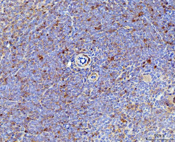 IL-17A/Il17a/IL Rabbit Polyclonal Antibody