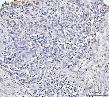 KIFC1 Rabbit Polyclonal Antibody