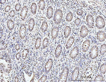 KIFC1 Rabbit Polyclonal Antibody