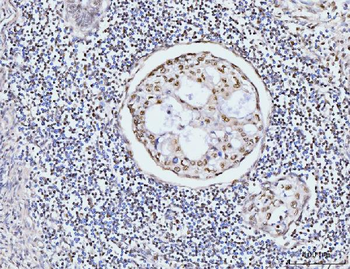 KIFC1 Rabbit Polyclonal Antibody