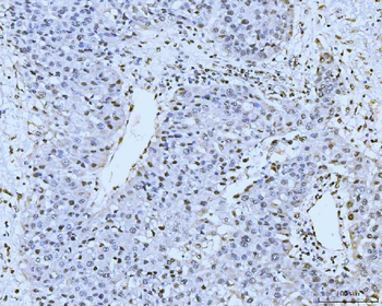 KIFC1 Rabbit Polyclonal Antibody