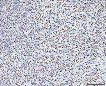 KIFC1 Rabbit Polyclonal Antibody