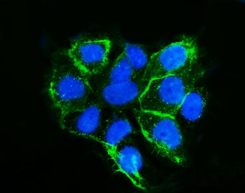 LSR Rabbit Polyclonal Antibody