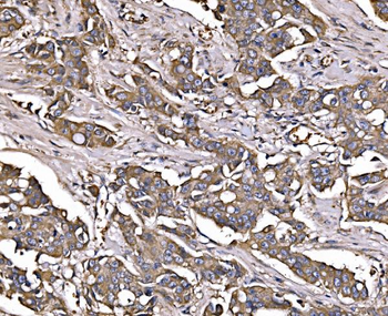 LSR Rabbit Polyclonal Antibody