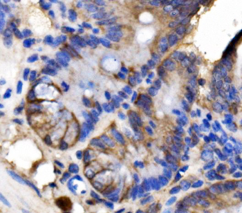 LSR Rabbit Polyclonal Antibody