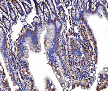 LSR Rabbit Polyclonal Antibody