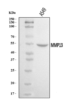 MMP13 Rabbit Polyclonal Antibody