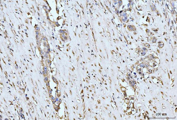 MOV10 Rabbit Polyclonal Antibody
