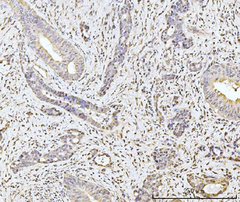 MOV10 Rabbit Polyclonal Antibody