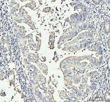 MOV10 Rabbit Polyclonal Antibody