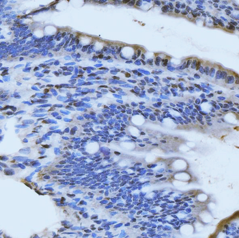 MRE11 Rabbit Polyclonal Antibody