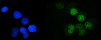 MRE11 Rabbit Polyclonal Antibody