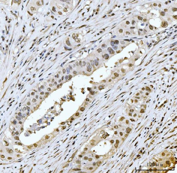 MRE11 Rabbit Polyclonal Antibody