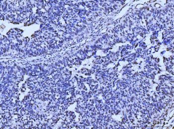 MRE11 Rabbit Polyclonal Antibody