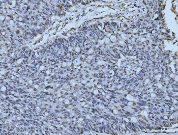 MRE11 Rabbit Polyclonal Antibody