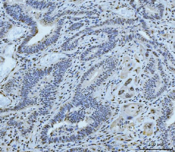 MRE11 Rabbit Polyclonal Antibody
