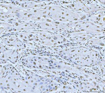MRE11 Rabbit Polyclonal Antibody
