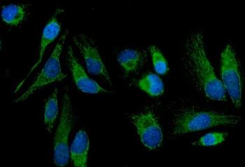 MT-ND5/MT Rabbit Polyclonal Antibody
