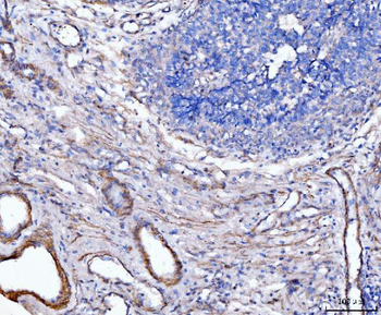 MT-ND5/MT Rabbit Polyclonal Antibody