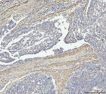 MT-ND5/MT Rabbit Polyclonal Antibody