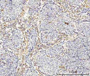 MT-ND5/MT Rabbit Polyclonal Antibody