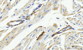 MT-ND5/MT Rabbit Polyclonal Antibody