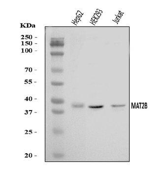 MAT2B/TGR Rabbit Polyclonal Antibody