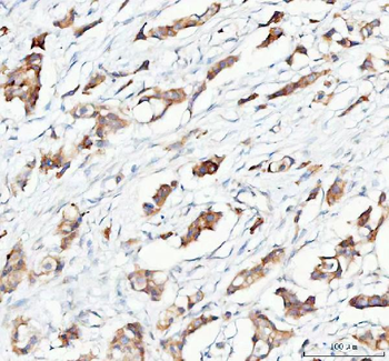 PTGES2/Gbf1 Antibody