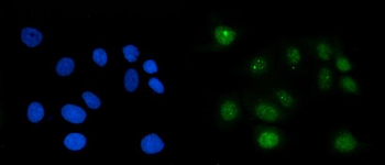 RAE1 Rabbit Polyclonal Antibody