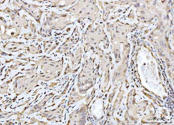 RAE1 Rabbit Polyclonal Antibody