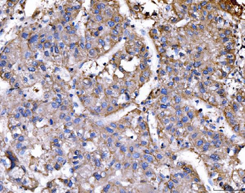 RAE1 Rabbit Polyclonal Antibody
