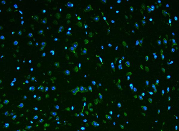 Rpl9 Rabbit Polyclonal Antibody