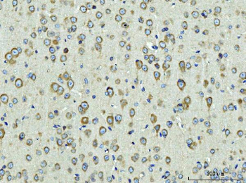 Rpl9 Rabbit Polyclonal Antibody