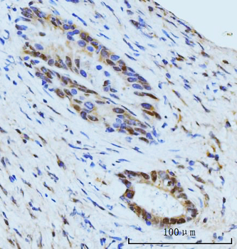 SBNO1 Antibody