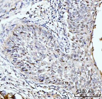 SBNO1 Antibody