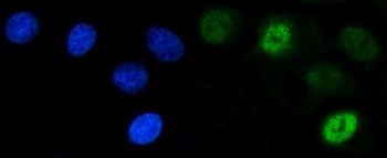 SCP3/SYCP3 Antibody