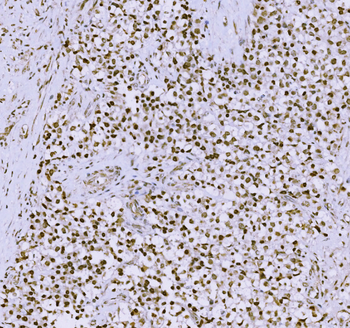 SCP3/SYCP3 Antibody